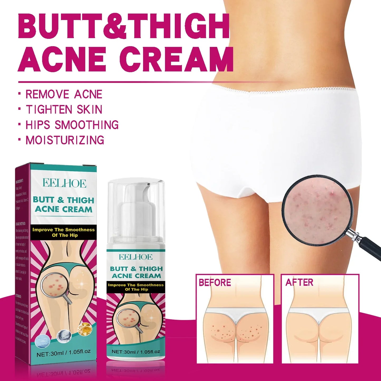 Butt Thigh Acne Clearing Cream Zits Razor Bumps Spot Treatment Preventing Sexy Hip Sagging Lift Whitening Buttocks Pimples Cream