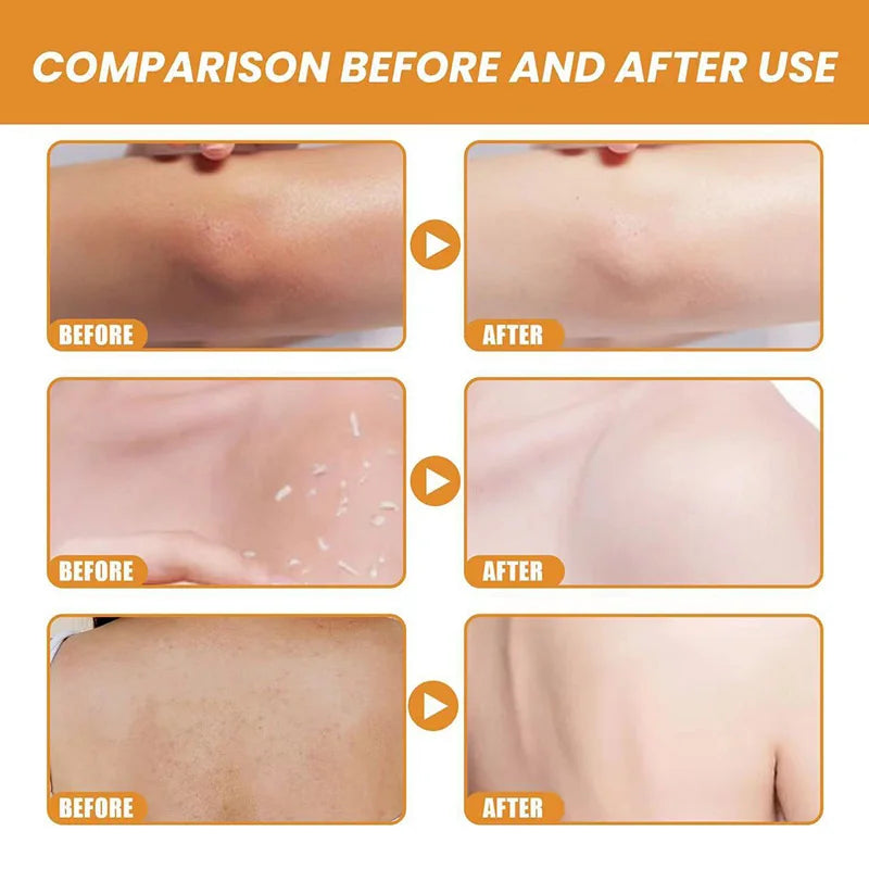 50g Orange Exfoliateing Gel Brightening Gel Face Dead Skin Remover Face Moisturizer Gently Exfoliator For All Skin New