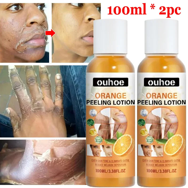 Strong Yellow Peeling Oil Bleach Dark Skin Whiten Lotion Lighten Body Elbow Knee Hand Exfoliate Dead Skin Nourish Even Skin Tone