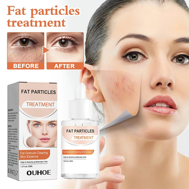 Fat Granules Removal Eye Serum Anti Dark Circle Eye Bags Fade Fine Line Essence Anti-puffiness Moisturizing Skin Care Products