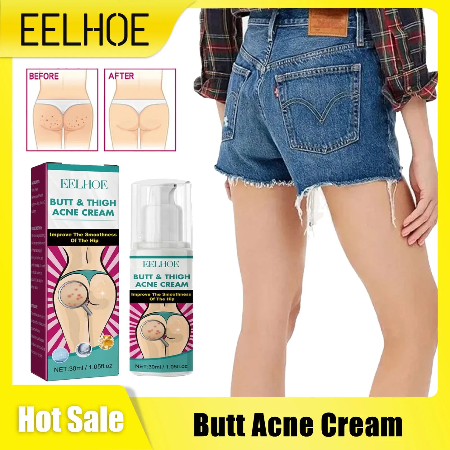 Butt Thigh Acne Clearing Cream Zits Razor Bumps Spot Treatment Preventing Sexy Hip Sagging Lift Whitening Buttocks Pimples Cream