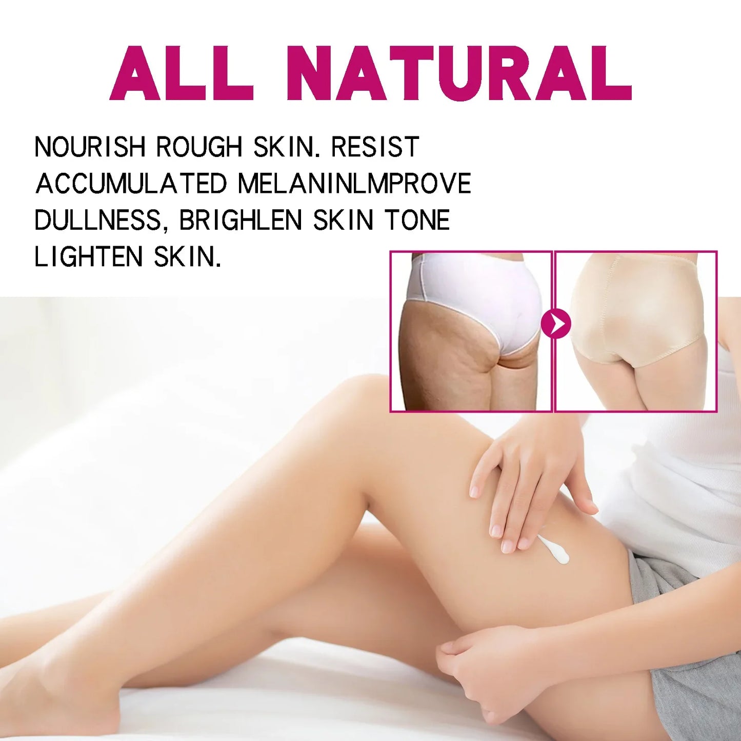 Butt Thigh Acne Clearing Cream Zits Razor Bumps Spot Treatment Preventing Sexy Hip Sagging Lift Whitening Buttocks Pimples Cream