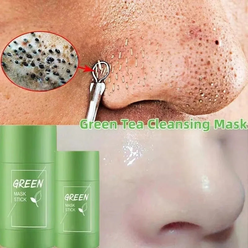 Original Facial Remove Blackhead Green Tea Solid Mask Treat Acne Blemish Black Dots Clean Stick Cream Shrink Pores Skin Care