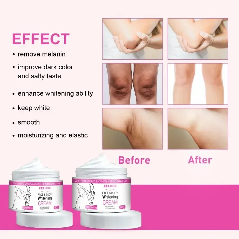 New Face Body Brightening Cream Thigh Underarm Inner Melanin Lightening Lotion Feminine Gentle Nourishing Dark Skin Care Cream