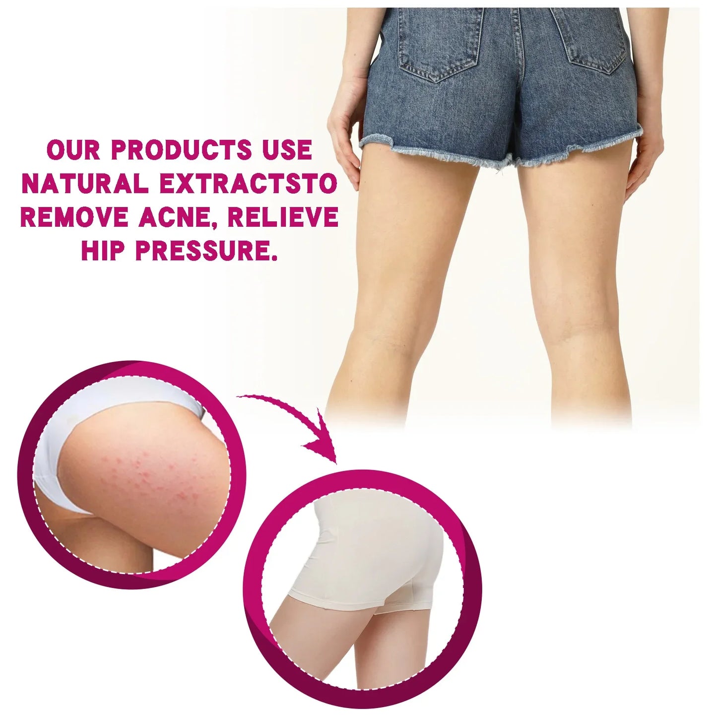 Butt Thigh Acne Clearing Cream Zits Razor Bumps Spot Treatment Preventing Sexy Hip Sagging Lift Whitening Buttocks Pimples Cream